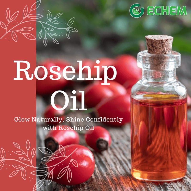 Rosehip Oil-100 ml